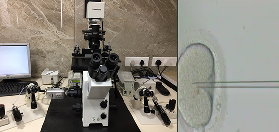 Intracytoplasmic Sperm Injection (ICSI) Treatment at Dr. Nagori Institute