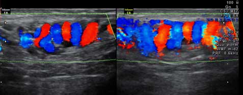 infertility-gynec-img-6