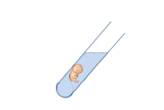 Assisted Reproduction Technology (IVF) Treatment at Dr. Nagori's Institute