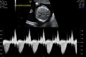 ultrasound-pragnancy-img-4