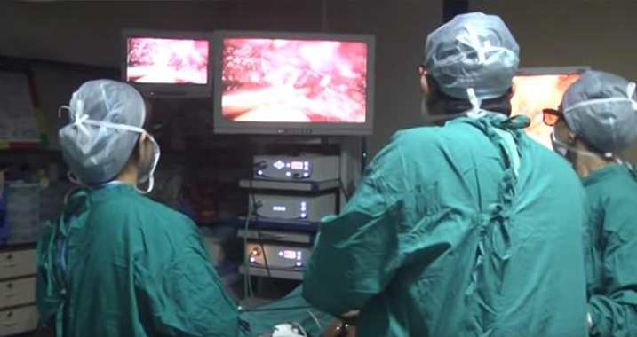 video-laparoscopy